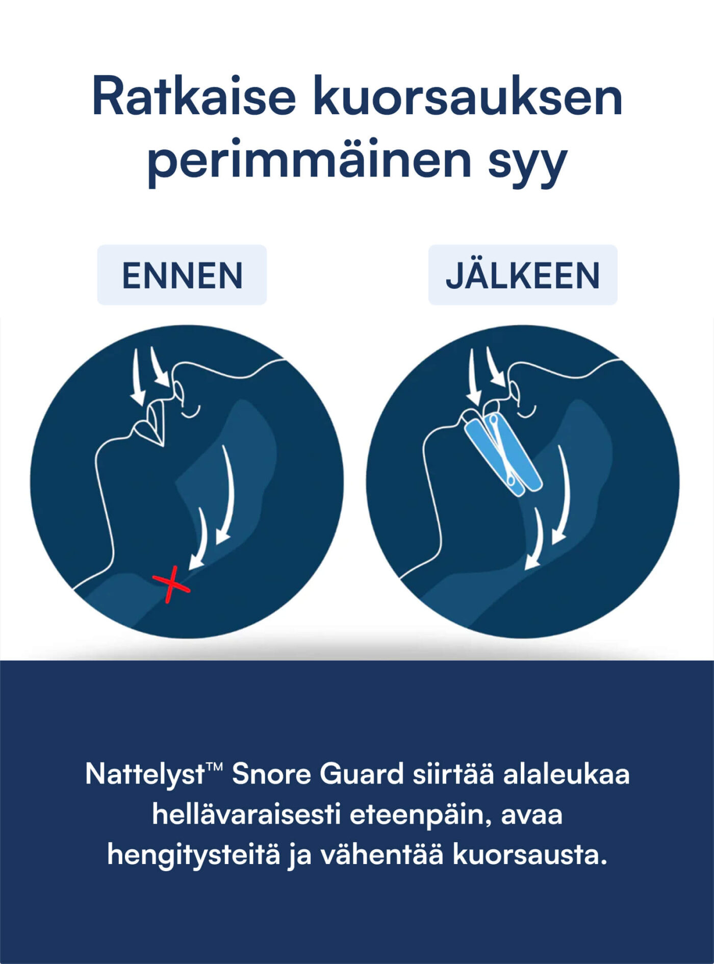 Kuorsauskisko (Snore Guard)